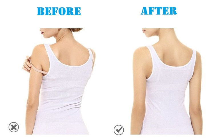 Fabme Women's Bra Back Strap Holder